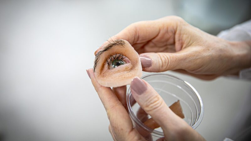 Reabilitação facial gratuita: a missão do Centro de Especialidades Odontológicas da UEA em transformar vidas