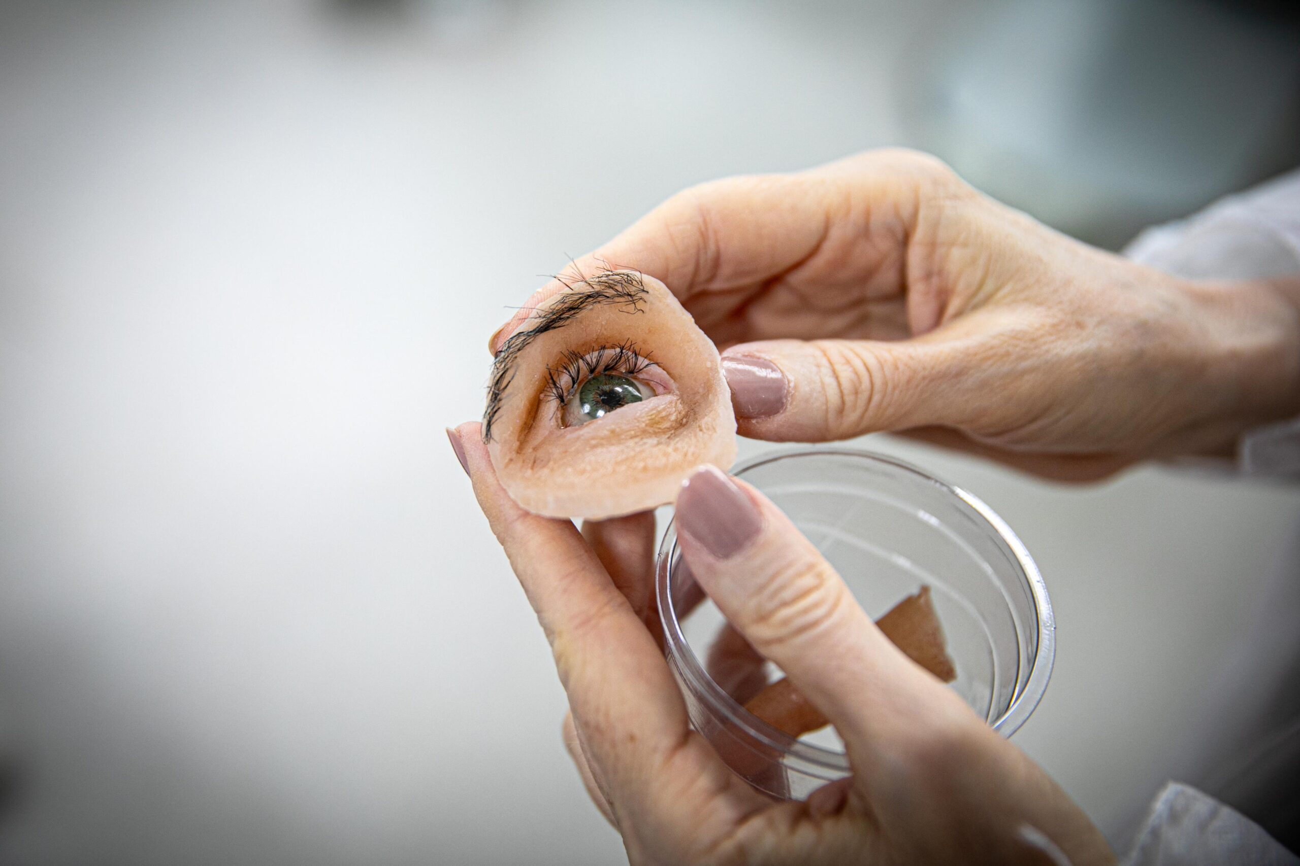 Reabilitação facial gratuita: a missão do Centro de Especialidades Odontológicas da UEA em transformar vidas