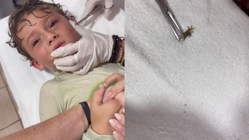 Criança tem caranguejo vivo retirado do ouvido após banho de mar