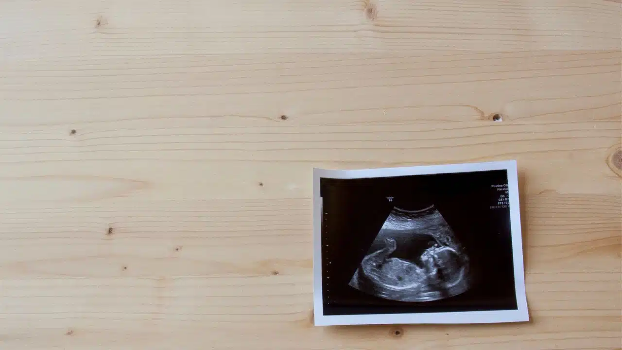 Japonesas e golpe: compra de ultrassons falsos para enganar os parceiros