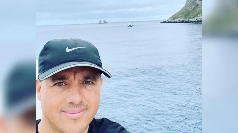 “Nunca me senti em perigo”, diz biólogo mordido por tubarão no rosto