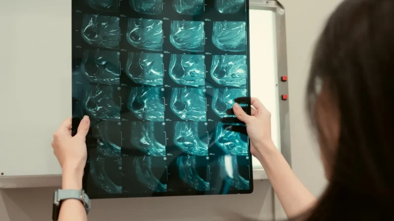 IA consegue prever risco de câncer de mama com 5 anos de antecedência