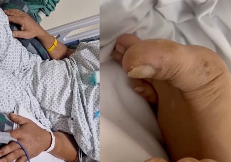 Mais um paciente tetraplégico mexe os braços e dedo do pé, após receber a polilaminina; vídeo